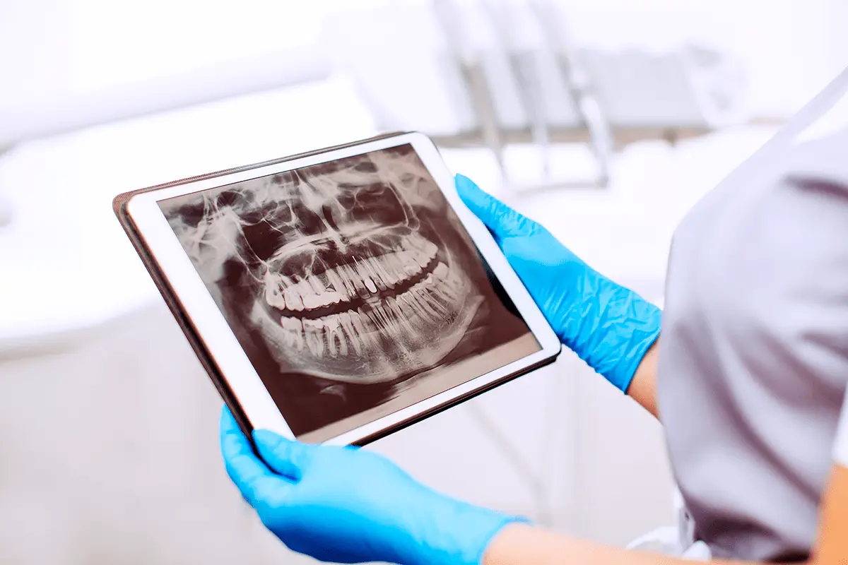 A importância da Radiografia nos tratamentos odontológicos 