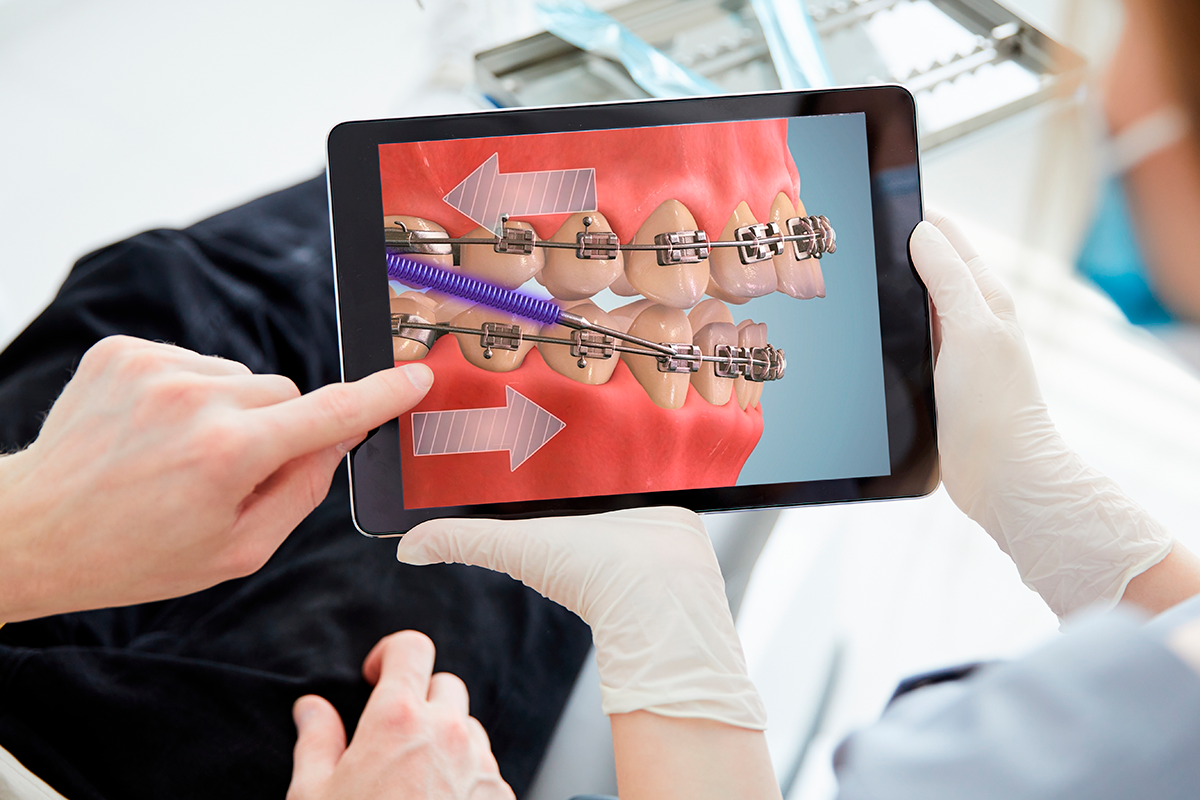 Descubra o DentalMaster e 7 vantagens de utilizar animações 3D nas suas consultas